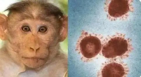 世卫组织：猴痘病毒已发生人际传播