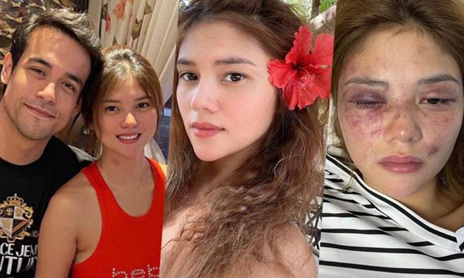 菲律宾知名男星因非法囚禁和殴打同为演员的女友而被捕！